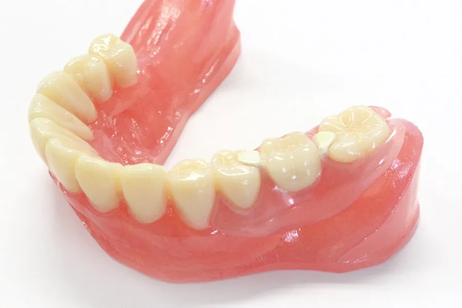 ホワイトレスト