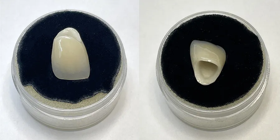 ジルコニアセラミックス